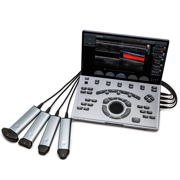 Ecógrafo Portátil SonoAir