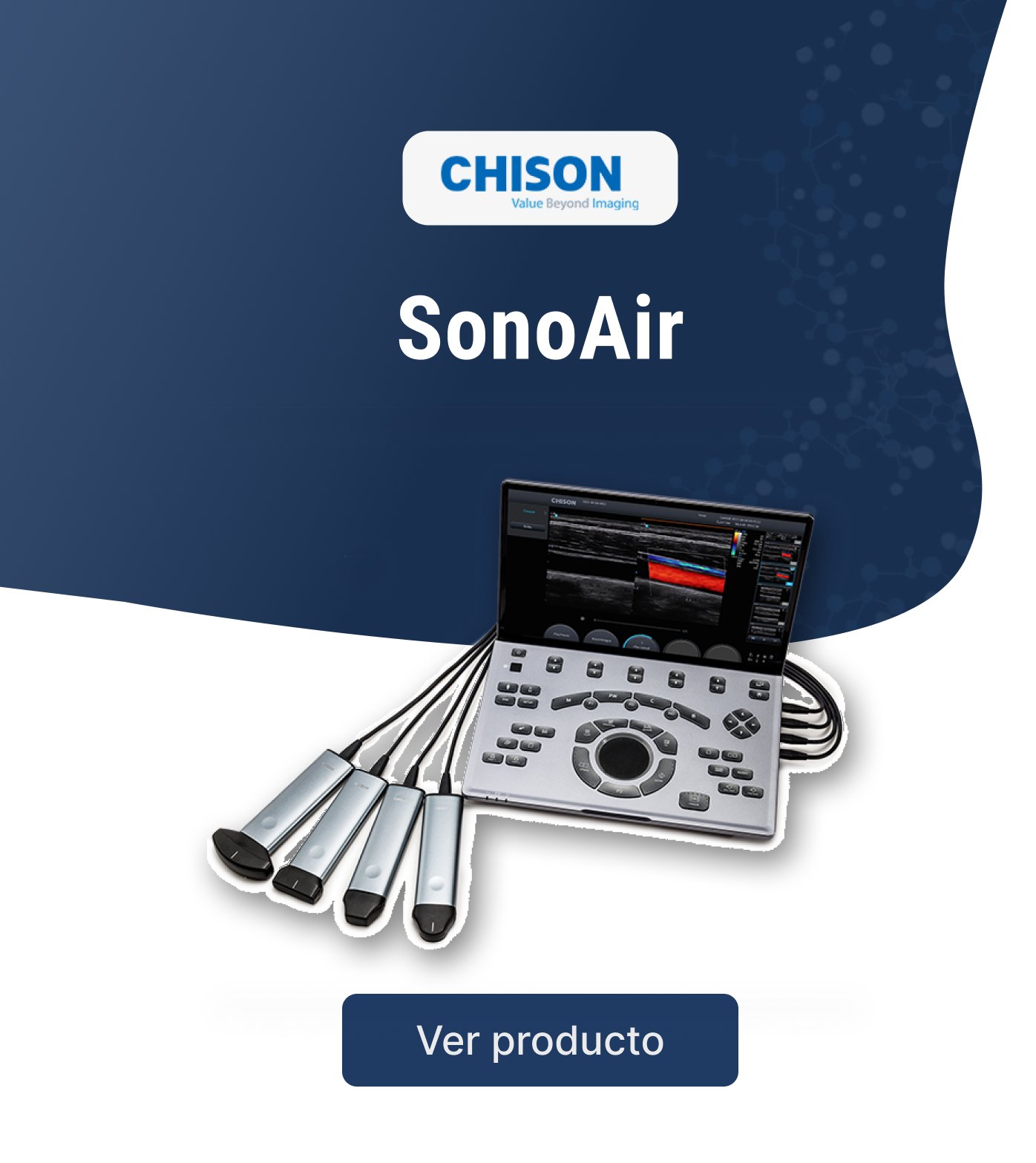 SonoAir