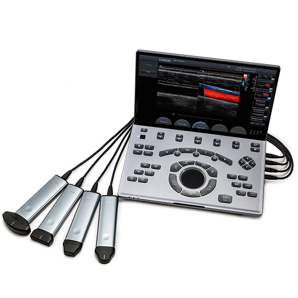 Ecógrafo Portátil SonoAir