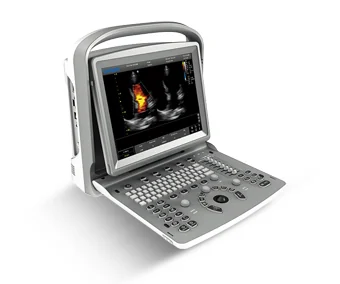 Ecógrafo Portátil Chison Eco 6